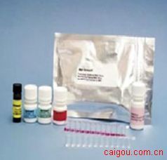 人细胞角蛋白17(CK17)ELISA试剂盒48T/96T_实验室耗材_生化仪器专用配件及消耗品_ELISA试剂盒_产品展示-中国教育装备采购网